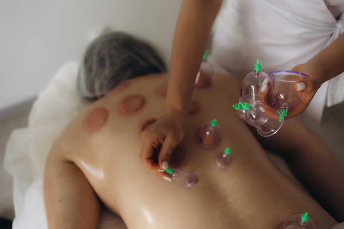 Dry cupping behandeling