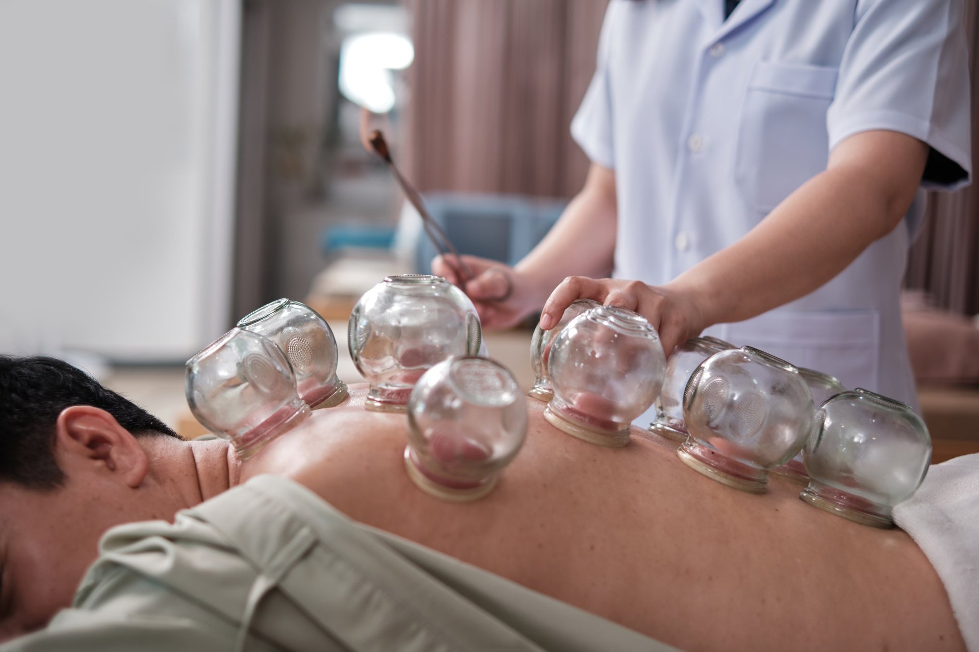 Mannelijke patiënt ontvangt cupping therapy behandeling